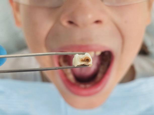 Best Walk-In Emergency Dentist in Central Heights Midland City, AZ